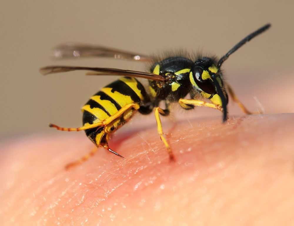 wasp-sting-treatment